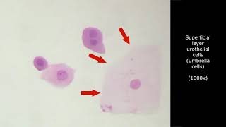 INTERPRETATION OF URINE CYTOLOGY Atlas and tutorial for cytotechnologist learning [upl. by Lukasz]