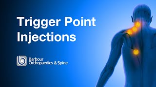 What is a Trigger Point injection [upl. by Kcirevam]