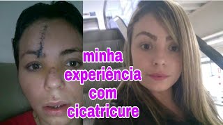 CICATRICURE FUNCIONA Minha experiência [upl. by Wallache]