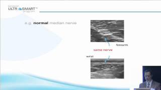 Terasons MSK Ultrasound Basics with Dr Visco Part 5 of 8 [upl. by Winther364]