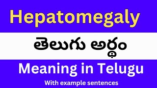 Hepatomegaly meaning in telugu with examples  Hepatomegaly తెలుగు లో అర్థం Meaning in Telugu [upl. by Eojyllib58]