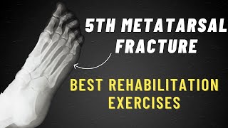 5th Metatarsal Fracture Exercises  6 Week Program [upl. by Gnat509]