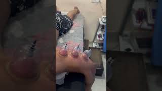 Full Back Relaxation in Physiotherapy  Back Pain  DukhNiwaran Physiotherapy [upl. by Maximo]