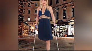 The beautiful amputee woman challenges disability with an artificial leg amputee [upl. by Aiker]