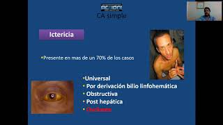 Colangitis aguda [upl. by Anitsua]