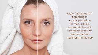 Radio Frequency Skin Tightening Treatment in Houston Texas [upl. by Blackstock]