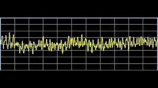 Scar Tissue  Rife Frequencies [upl. by Adnolat]