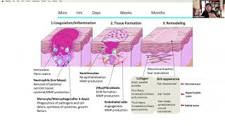 Myhre Research Family amp Patient QampA Session 5 [upl. by Cedell632]