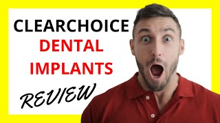 🔥 ClearChoice Dental Implants Review Pros and Cons [upl. by Marven]