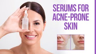 5 Best Serum for Acne Prone Skin [upl. by Grearson]