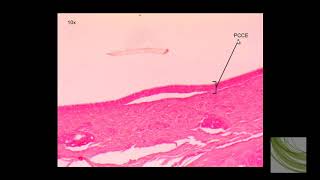 SLIDE Pseudostratified Ciliated Columnar Epithelium PCCE [upl. by Jamel]