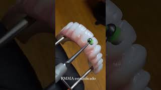 Protocolo PMMA Estratificado🔥 shortsvideo tpd exocad dentista prótesedentária dentist [upl. by Hanej]