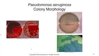 Nonfermenting Gram Negative Bacilli [upl. by Sly]