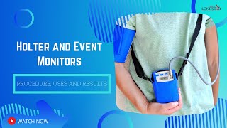 Holter and Event Monitors Procedure Uses and Results [upl. by Alithia]