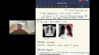 BRONCHIAL ASTHMA For University Studentsl Dr Sahil Bansal [upl. by Enomyar877]