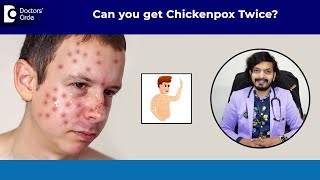 Can you get CHICKENPOX Twice Chickenpox Vaccine amp Treatment DrLeela Mohan P V R Doctors Circle [upl. by Shalne807]