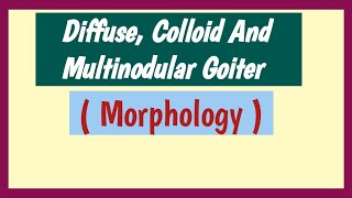 Diffuse Colloid And Multinodular Goiter  Pathology Morphology [upl. by Atterrol]