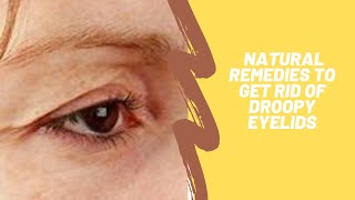 natural remedies to get rid of droopy eyelids [upl. by Cone]