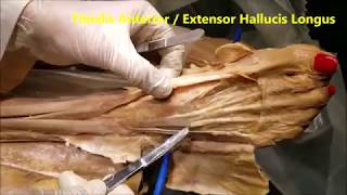 FOOT DORSUM Tendons Muscles Neurovascular and Clinical Correlations – Sanjoy Sanyal [upl. by Nnayllek]