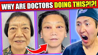 EXTREME Asian Plastic Surgery TikToks WHY [upl. by Jeraldine]