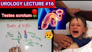 Urology surgery lecture 16 torsion of testis testicular appendages orchitis [upl. by Granese]