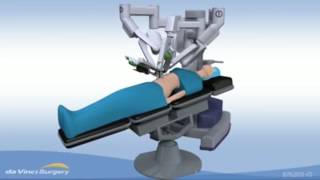 Cholecystectomy  Gallbladder Removal with da Vinci® [upl. by Thaine310]