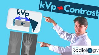 kVp and xray Contrast Guide for Radiologic Technologists [upl. by Adnalue]