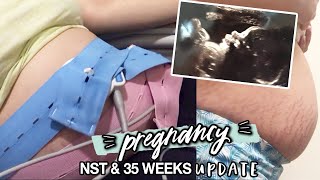 35 WEEKS PREGNANT  FAILED MY FIRST NST NONSTRESS TEST 😭 [upl. by Anirbus423]