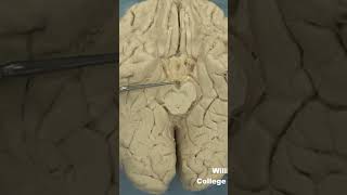 Posterior perforated substanceanatomy biology brainstemneuroanatomymidbrain [upl. by Kaazi]