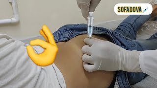 intramuscular IM shot an injection into the gluteal muscle [upl. by Vitoria]