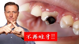 不再蛀牙預防蛀牙柏格醫生 Dr Berg [upl. by Anneh]