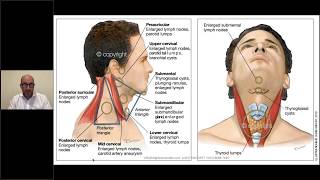 Neck lumps in general practice [upl. by Itsirk515]