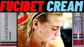 fucibet cream use in hindi how to use fucibet cream side amp effects and benefits [upl. by Gnanmos290]