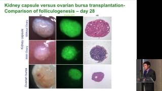 Germline Stem Cells and Therapeutic Potential  Lin Liu [upl. by Medlin75]