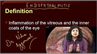 Endophthalmitis  Dr Niha Aggarwal [upl. by Aninay]