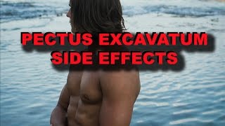 PECTUS EXCAVATUM SIDE EFFECTS [upl. by Enilaf]