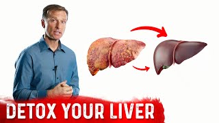 A Surprising Way To Cleanse Fatty Liver – Dr Berg On Liver Detoxification [upl. by Libbie915]