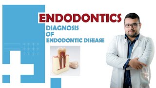 Diagnosis of endodontic disease [upl. by Nivlen]