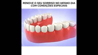 Condições Especiais Para Implantes Dentários  OdontoCompany Jardim Pérola [upl. by Masry]