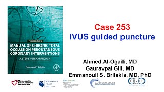 Case 253 Manual of CTO PCI  IVUS guided puncture [upl. by Sirahc]