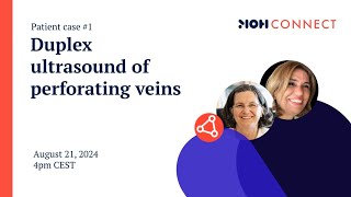 MOH Connect  Duplex ultrasound of perforating veins  Patient case 1 [upl. by Questa211]