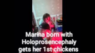 Marina born with Holoprosencephaly loves her chickens [upl. by Nomed227]