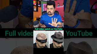 सावधानी क्या रखे hair transplant मे hairtransplant carehairtransplant shorts [upl. by Byrd757]