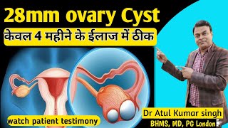 ovary Cyst treatment  Homeopathic treatment of ovarian cyst  ovary की गाँठ को कैसे ठीक करें [upl. by Yblek]