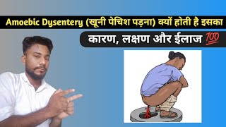 Amoibic Dysentery  खूनी पेचिश पड़ना। [upl. by Annanhoj]