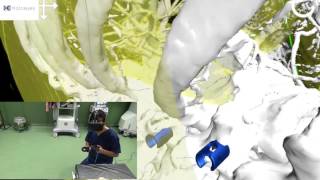 Virtual reality VR based simulators for spine surgery [upl. by Alohcin]