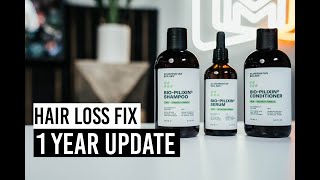 1 Year To Fix Hair Loss l Scandinavian Biolabs Test Results [upl. by Adrell]