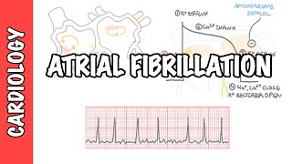 Atrial Fibrillation Overview  ECG types pathophysiology treatment complications [upl. by Clint39]