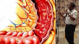 Bacillary Dysentery SHIGELLOSIS [upl. by Annayad]