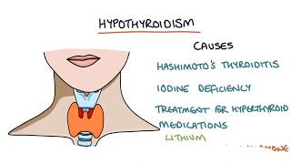 Hypothyroidism and Hashimotos Thyroiditis Visual Explanation for Students [upl. by Letsirhc]